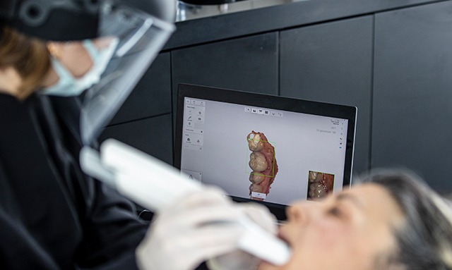 Dijital Diş Tasarımı