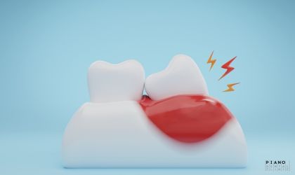 diş eti hastalıkları ve tedavileri | Piano Dental Clinic | Estetik Diş Hekimliği | Dental İmplantlar