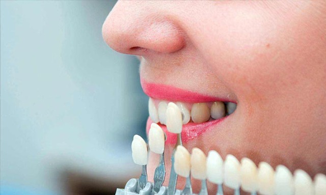 Kanal Tedavisi Yenileme | Piano Dental Clinic | Estetik Diş Hekimliği | Dental İmplantlar Kanal Tedavisi Tekrarı ( Retreatment )