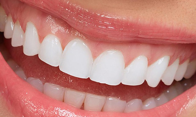 Tam Seramik Kuron | Piano Dental Clinic | Estetik Diş Hekimliği | Dental İmplantlar Tam Seramik Kuron